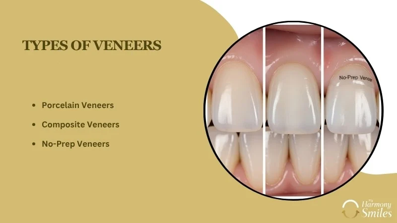The Complete Guide to Veneers and Crowns: Which Is Right for You? - My Harmony Smiles