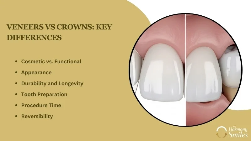 The Complete Guide to Veneers and Crowns: Which Is Right for You? - My Harmony Smiles