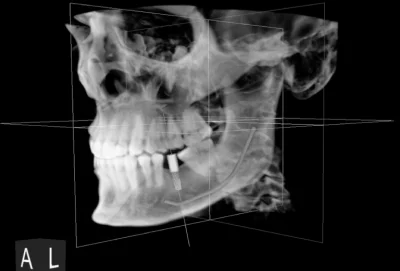 About us Our Technology - My Harmony Smiles