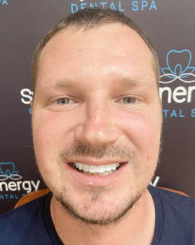 Restorative Dentistry Dental Implants - My Harmony Smiles