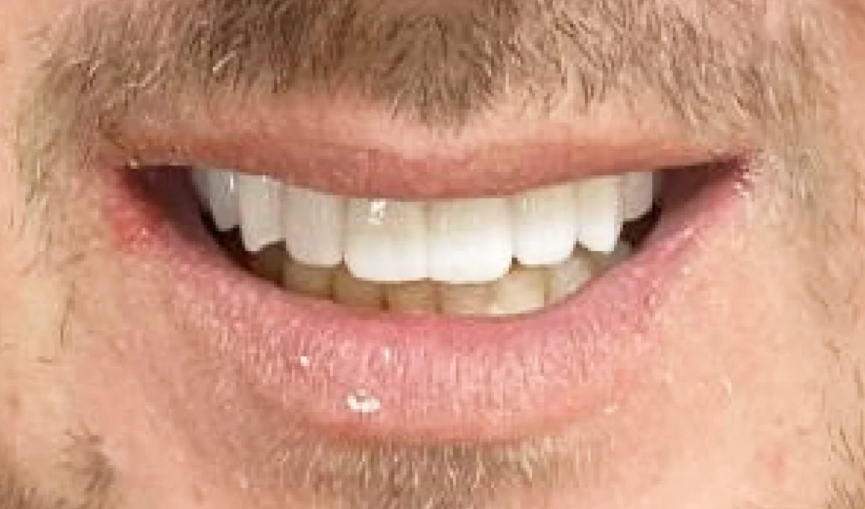 Locations Lux Dental and Spa - My Harmony Smiles