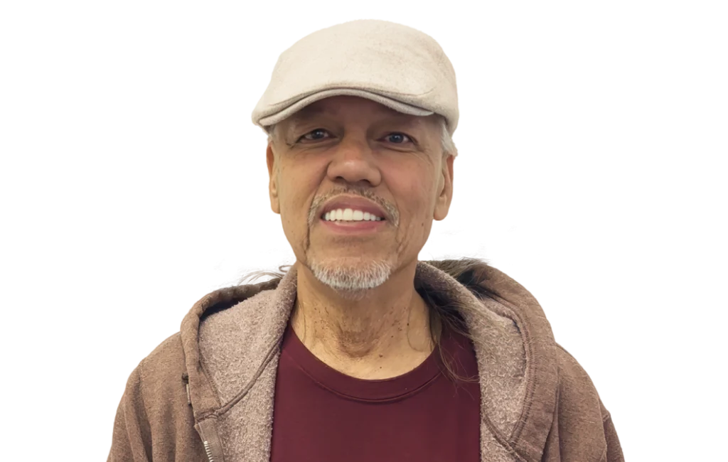 Smile Gallery - My Harmony Smiles