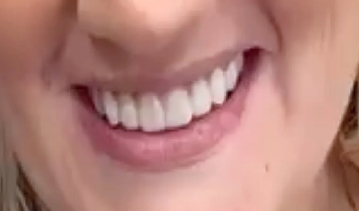 Locations Lux Dental and Spa - My Harmony Smiles