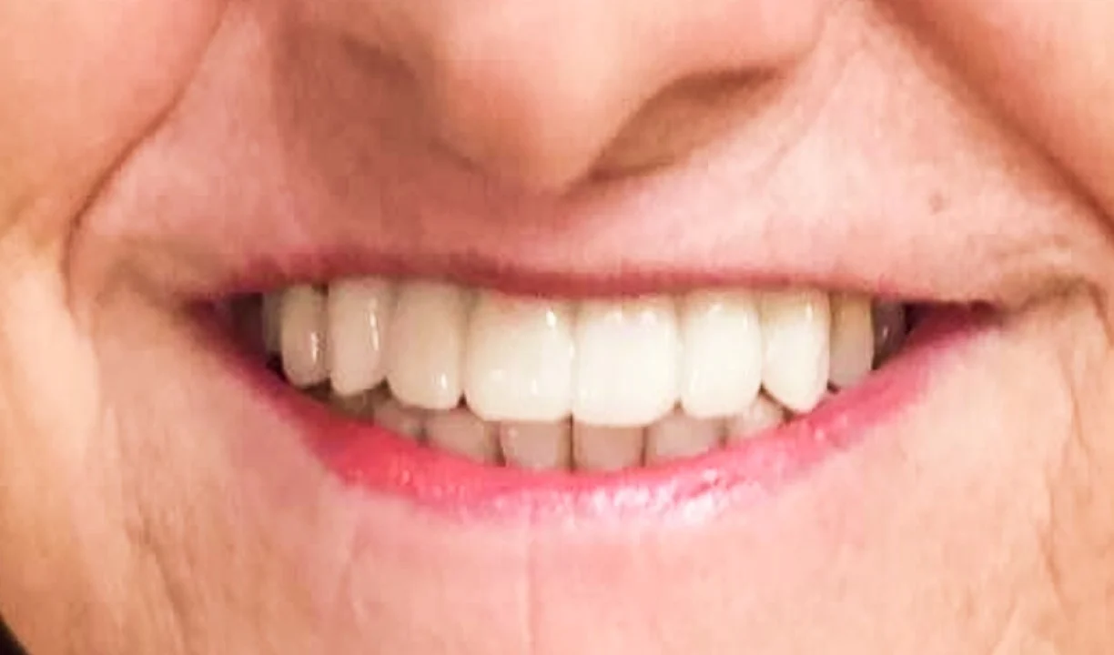 Locations Lux Dental and Spa - My Harmony Smiles