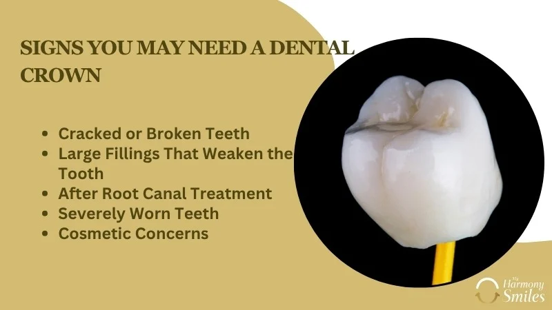 Signs You May Need a Dental Crown