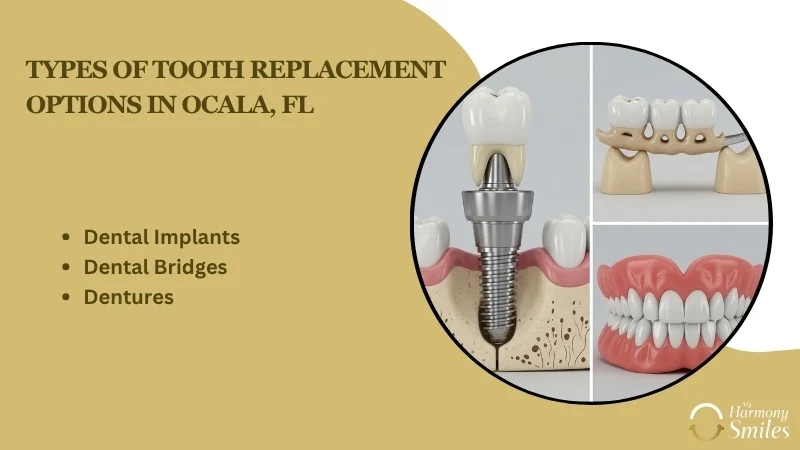 Best Options for Tooth Replacement in Ocala, FL: Your Complete Guide - My Harmony Smiles