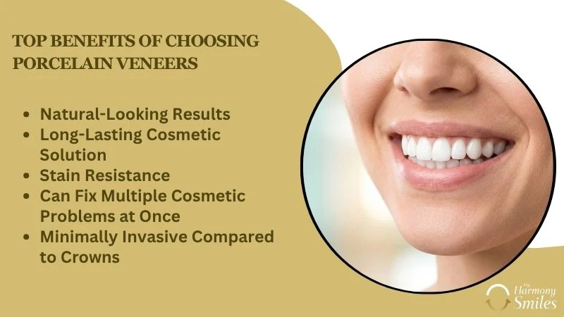Top Benefits of Choosing Porcelain Veneers