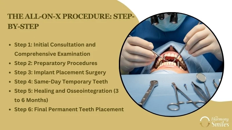 All-on-X Dental Implants Guide: Everything You Need to Know - My Harmony Smiles