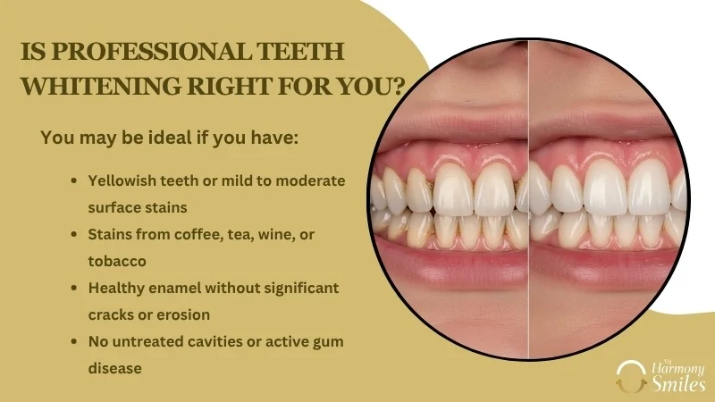 How Long Does Teeth Whitening Last? Treatment, Aftercare & Results Explained - My Harmony Smiles