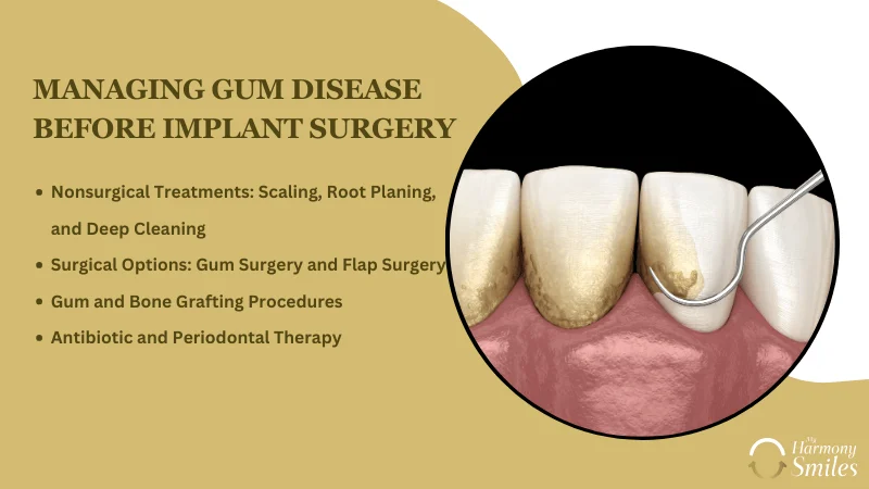 Treating Gum Disease Prior to Implant Placement