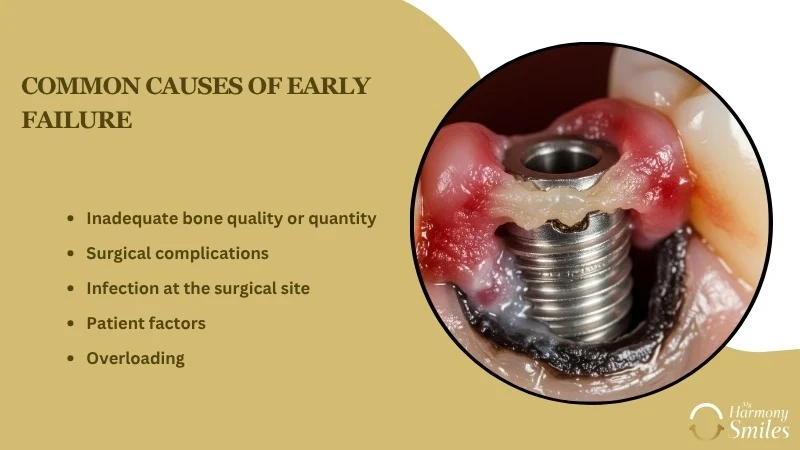 Dental Implant Failure vs Rejection: What Is the Difference? - My Harmony Smiles