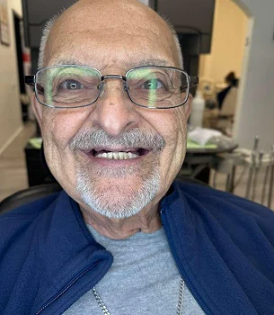 Facial aesthetics Micro-Needling Potenza - My Harmony Smiles