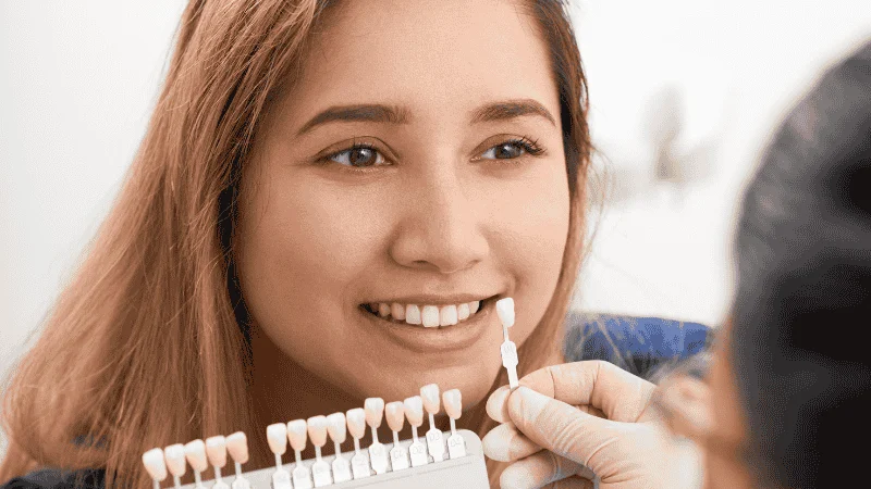 are veneers reversible