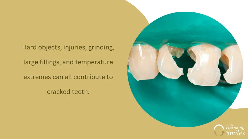 Common Causes of Cracked Teeth