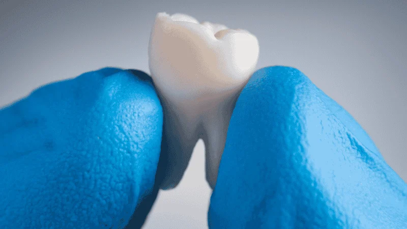 emergency dentist knocked out tooth