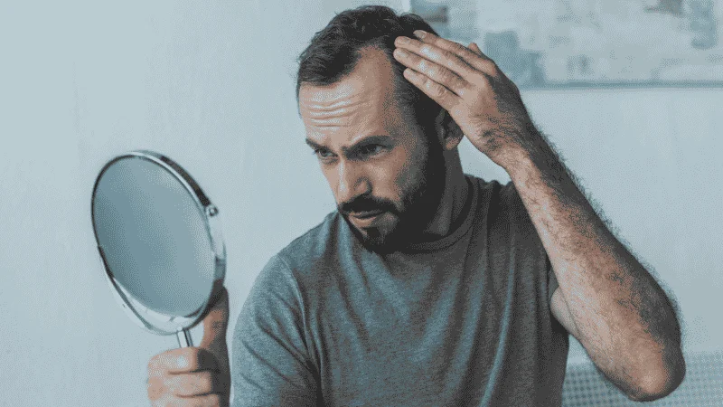 prf for hormonal hair loss