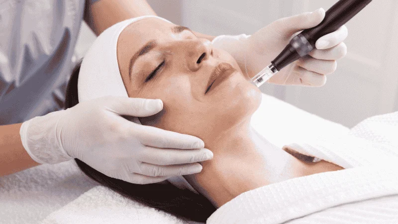 prf microneedling candidates