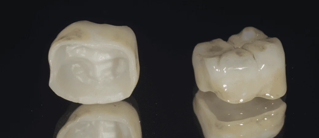 Ceramic Crowns and Their Advantages