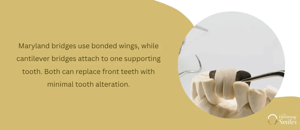Considering a Maryland Bridge or Cantilever Bridge for Front Teeth