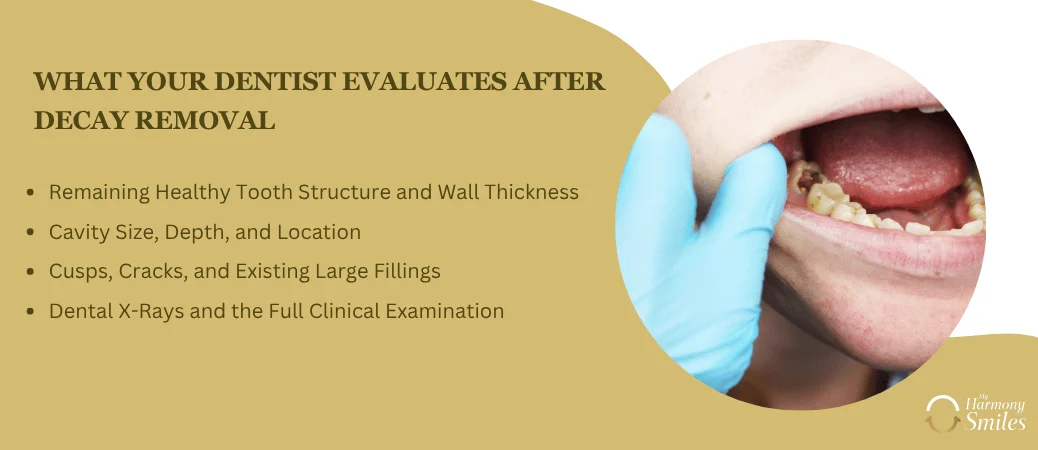 What Dentists Evaluate After Removing Decay